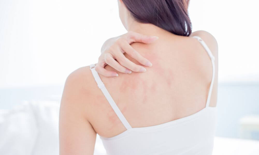 Causes of damaged skin