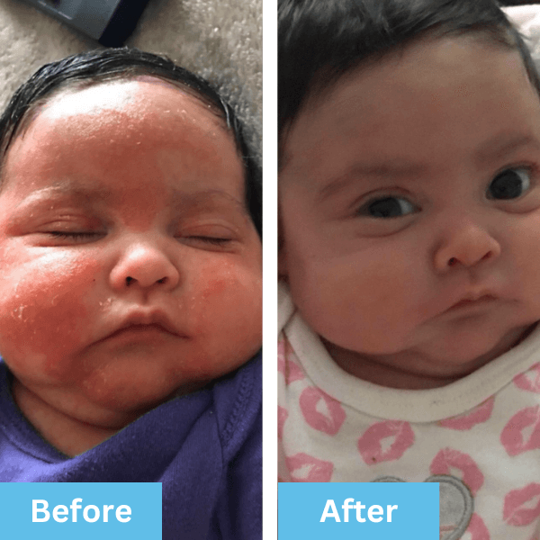 Before and after photo shared by an Era Organics family