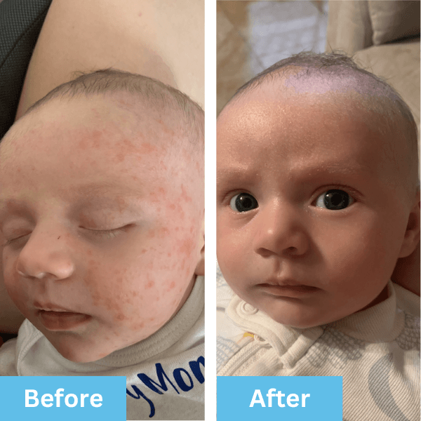 Before and after photo shared by an Era Organics family