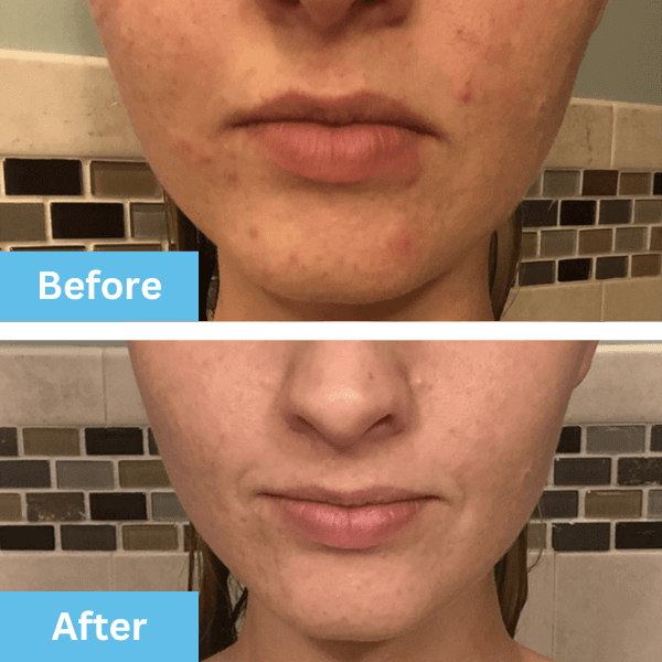 Before and after photo shared by a customer