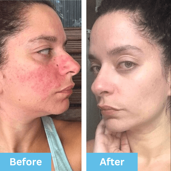 Before and after photo shared by a customer