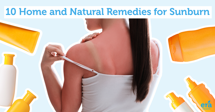 10 Home and Natural Remedies for Sunburn