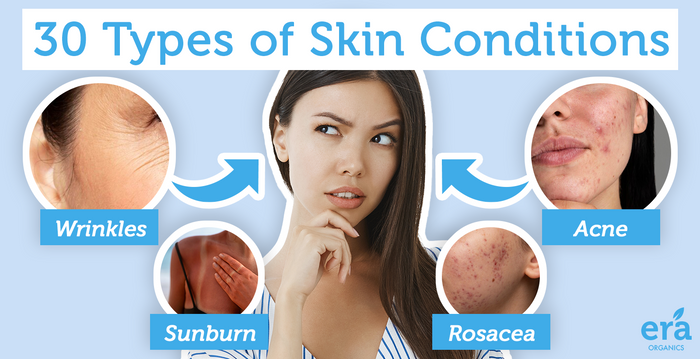 30 Types of Skin Conditions