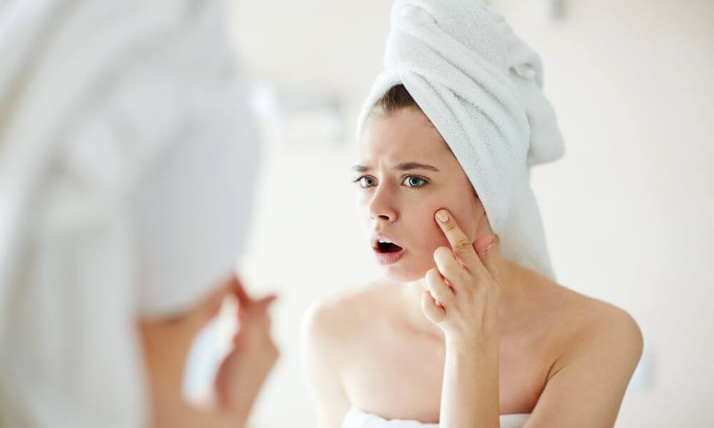Acne treatments making your acne worse
