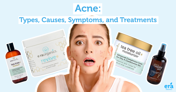 acne on girl's face