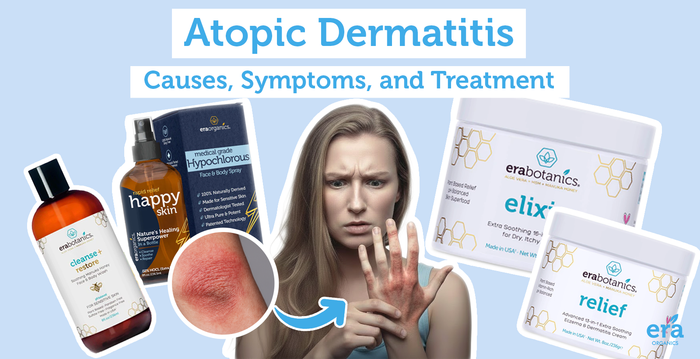 Atopic Dermatitis: Causes, Symptoms, and Treatment