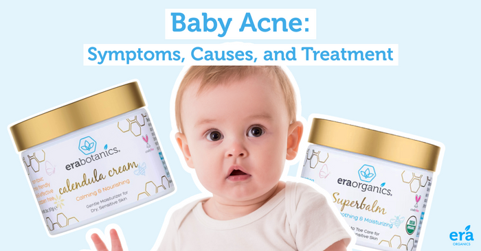 baby acne