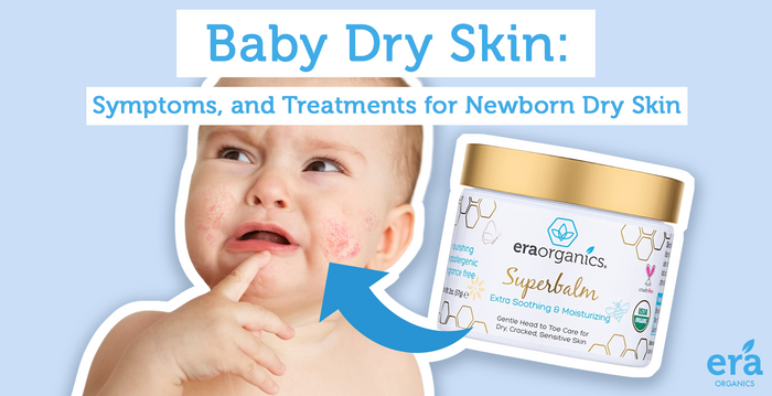 baby dry skin 