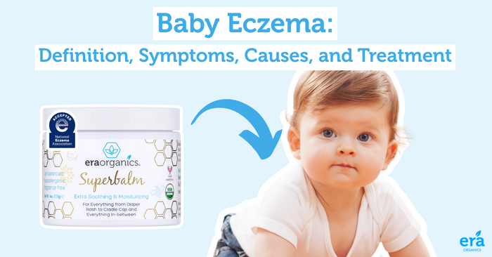 Baby Eczema