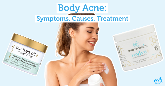 body acne