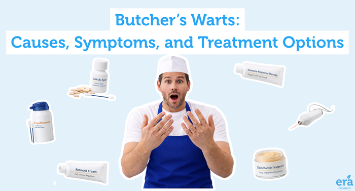Butcher’s Warts Causes, Symptoms, and Treatment Options