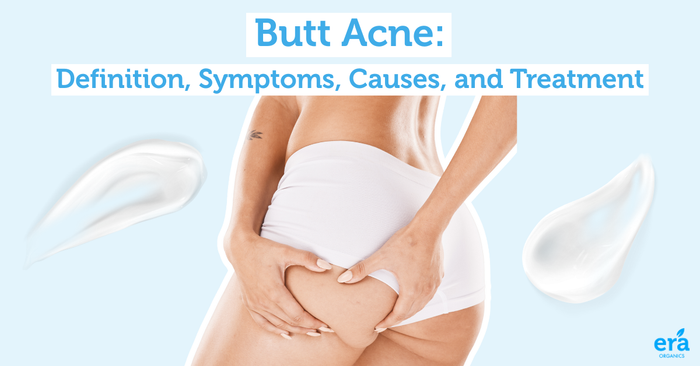 butt acne