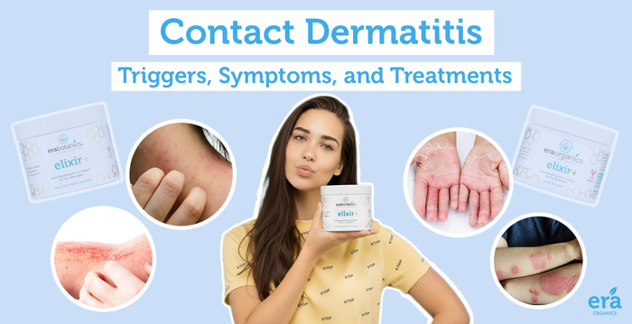 Contact Dermatitis: Triggers, Symptoms, and Treatments