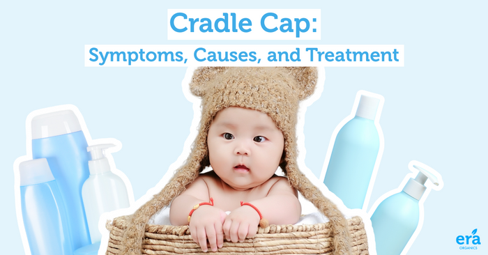 cradle cap 