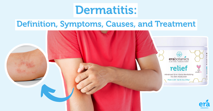 Dermatitis