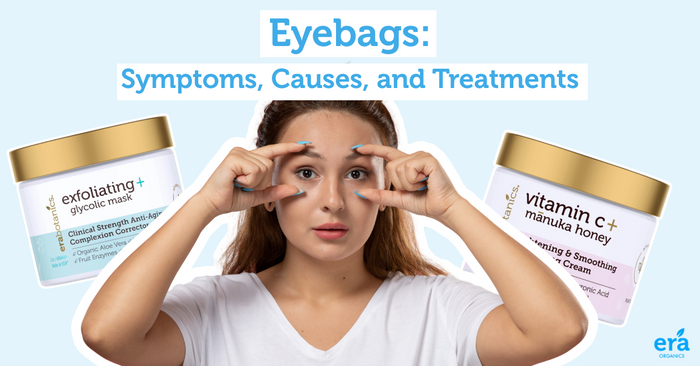 eye bags