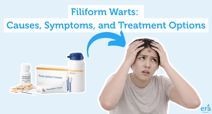 Filiform Warts: Causes, Symptoms, and Treatment Options