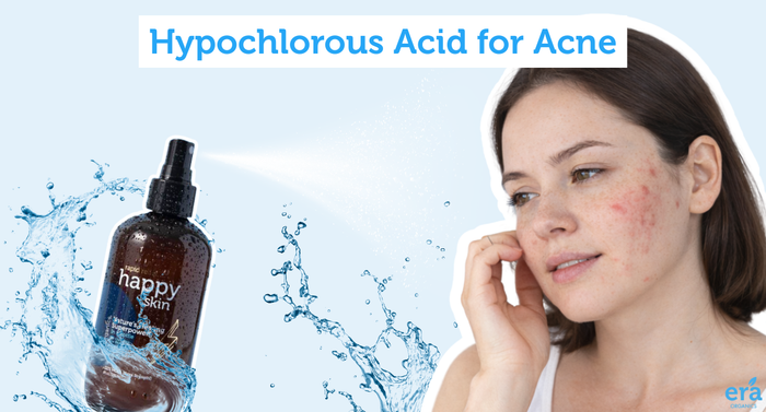 Hypochlorous Acid for Acne