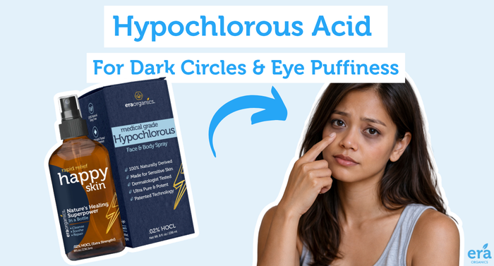 Hypochlorous Acid for Dark Circles and Eye Puffiness