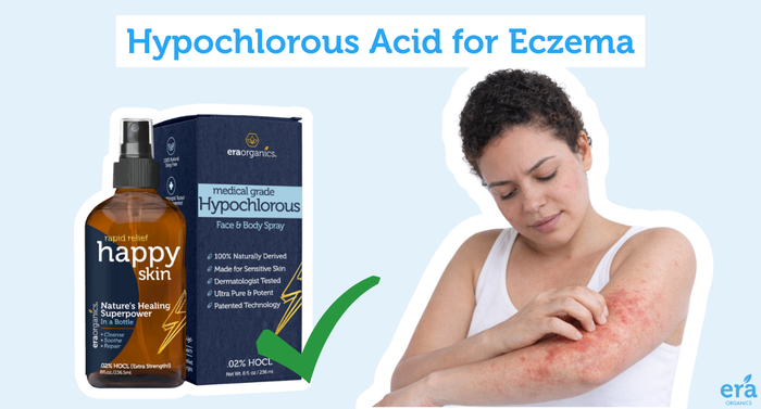 Hypochlorous Acid for Eczema