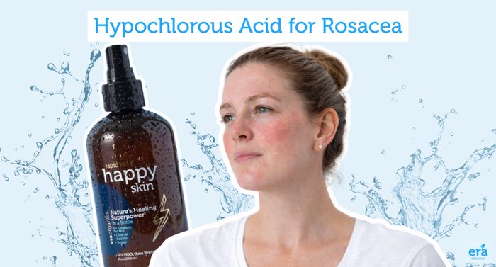 Hypochlorous Acid for Rosacea