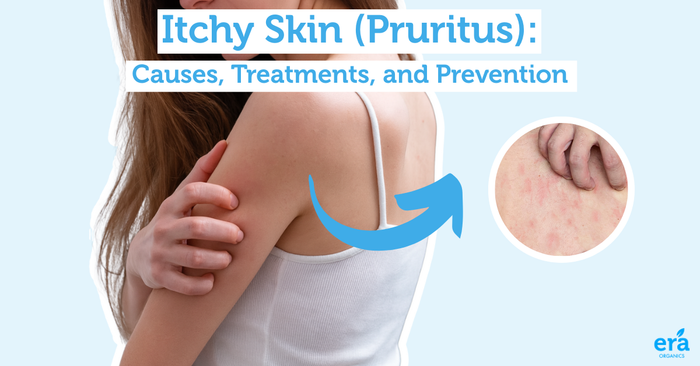 Itchy Skin (Pruritus): Causes, Treatments, and Prevention