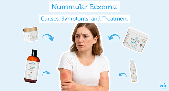 Nummular Eczema: Causes, Symptoms, and Treatments
