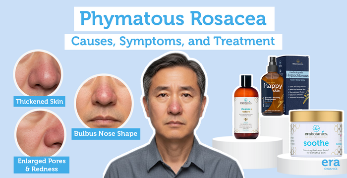 Phymatous Rosacea: Causes, Symptoms, and Treatment