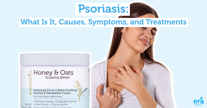 Psoriasis_ What Is It, Causes, Symptoms, and Treatments