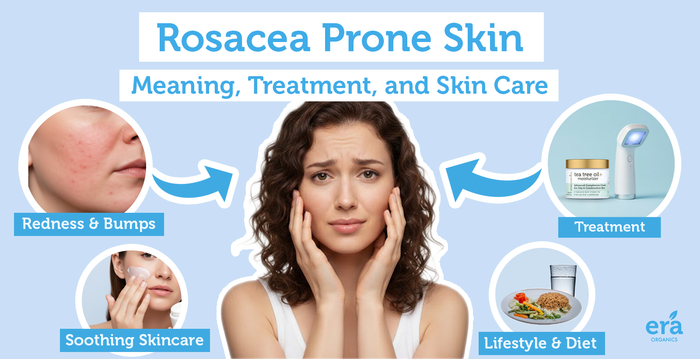 rosacea prone skin