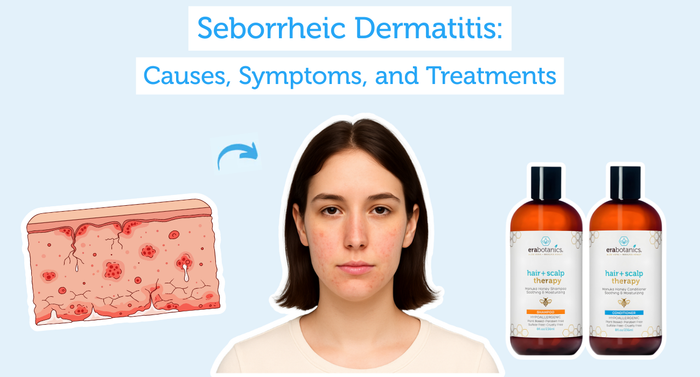 Seborrheic Dermatitis: Causes, Symptoms, and Treatments