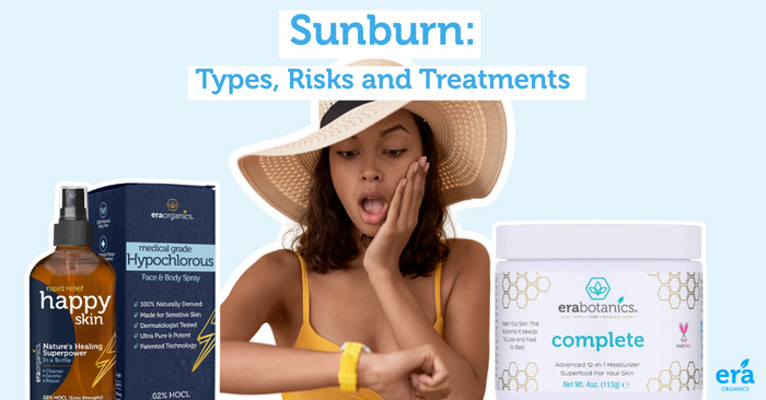Sunburn: Types, Risks and Treatments
