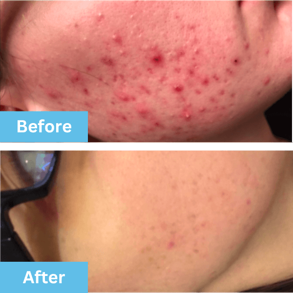 Before and after photo shared by a customer