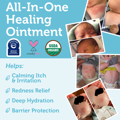 Healing Ointment Baby Eczema Cream