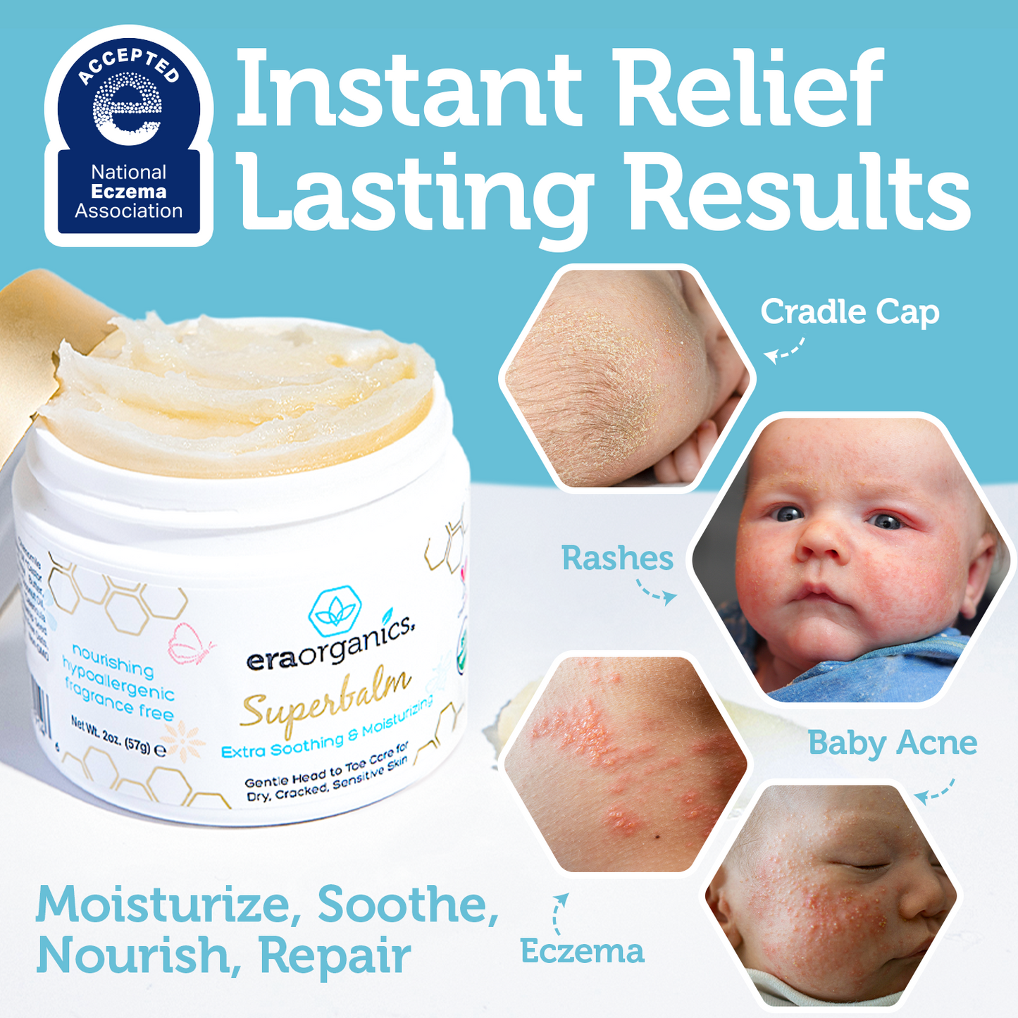 Healing Ointment Baby Eczema Cream