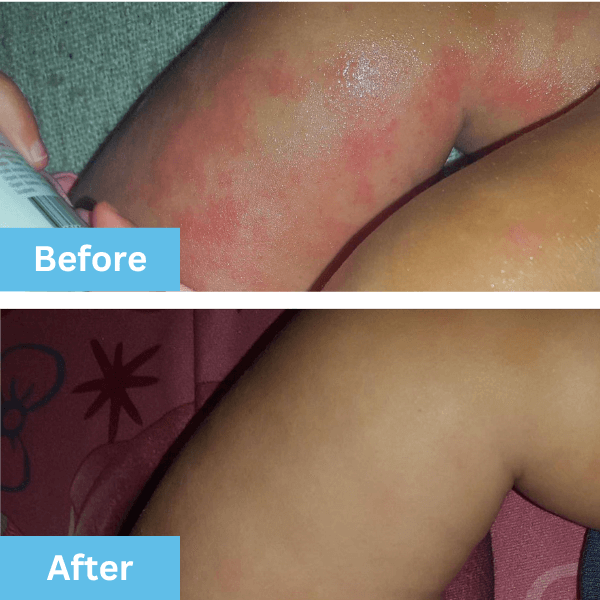Customer-submitted before and after result using Superbalm