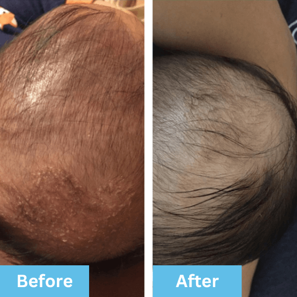Before and after photo shared by an Era Organics family