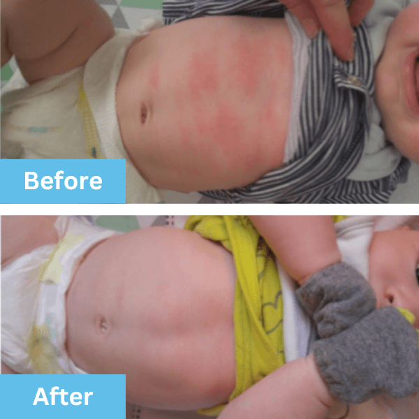 Before and after 2