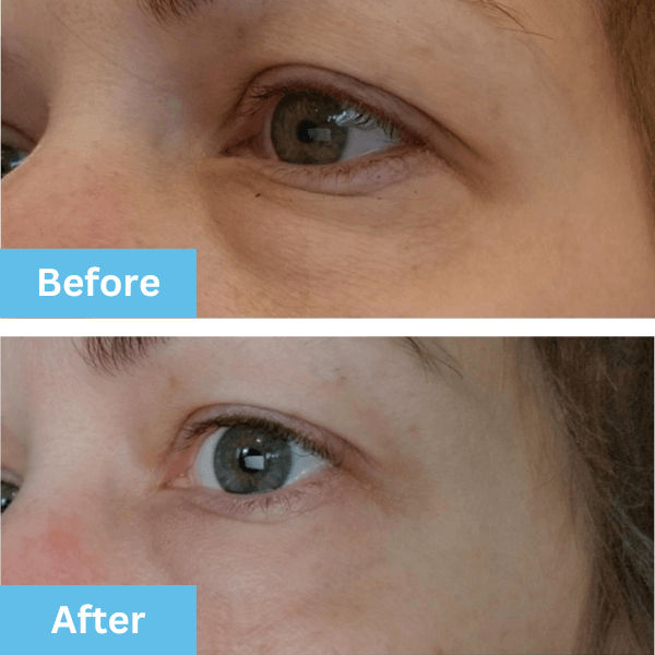 Before and after photo shared by a customer