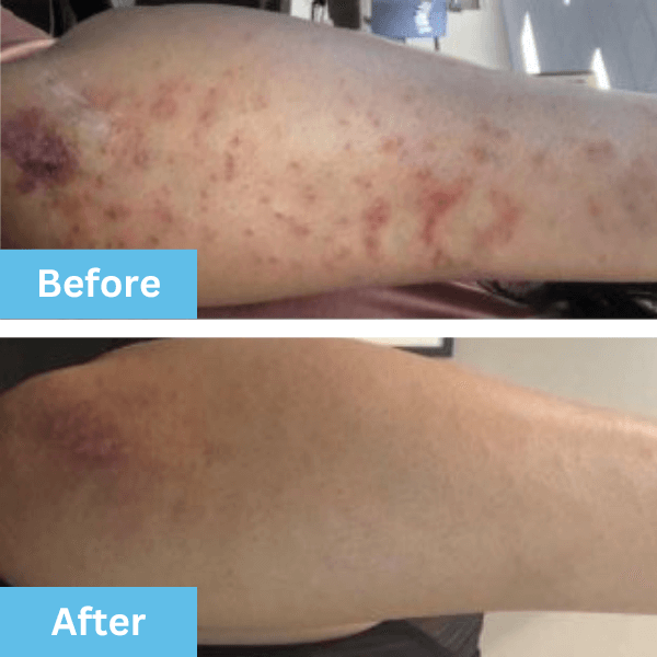 Before and after photo shared by a customer