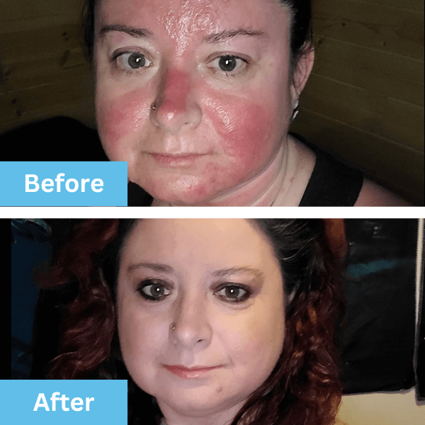 Before and after photo shared by a customer