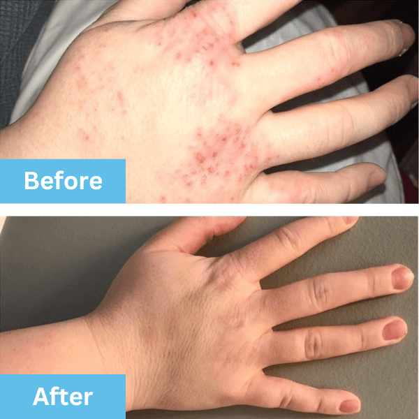 Before and after photo shared by a customer