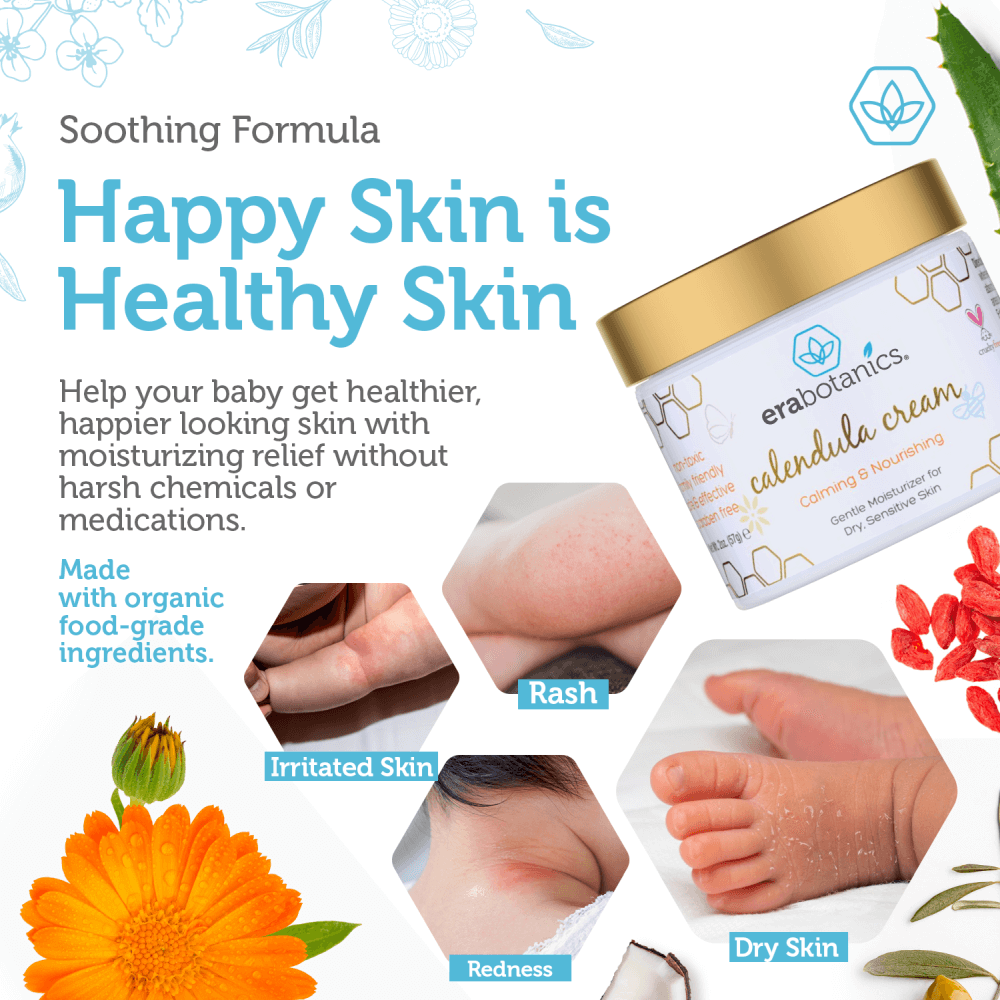 Calendula cream deals for baby eczema