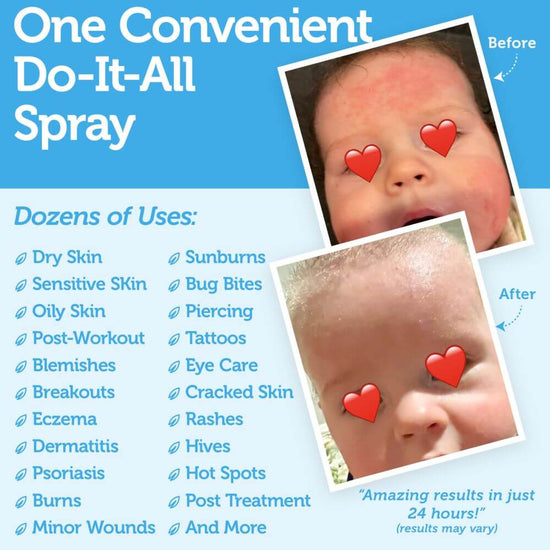 buy-the-best-hypochlorous-acid-hocl-spray-for-face-era-organics