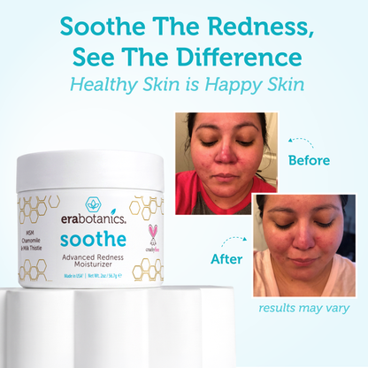 Rosacea cream
