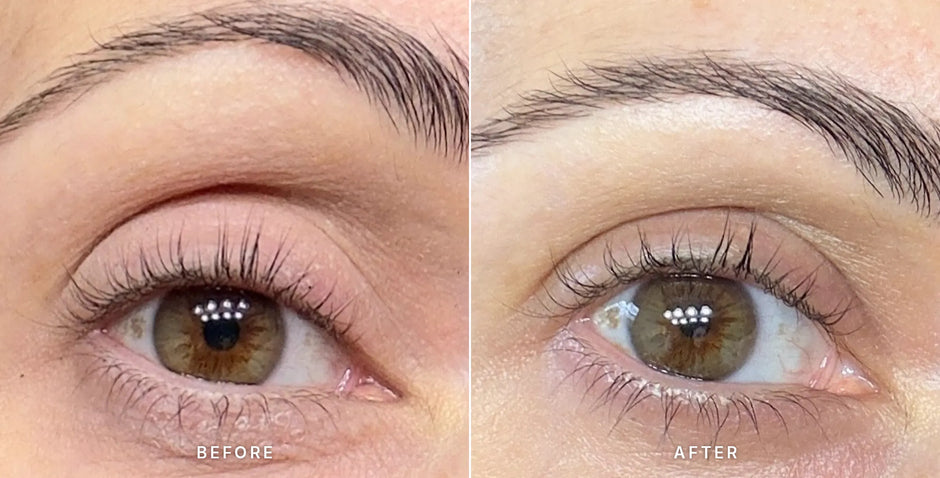 Before and after photos of an eye area