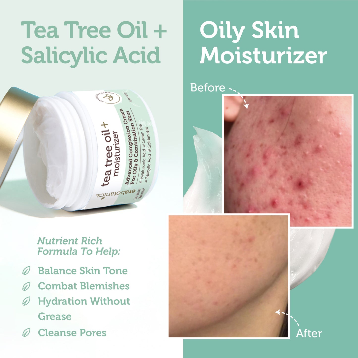 Tea tree cream
