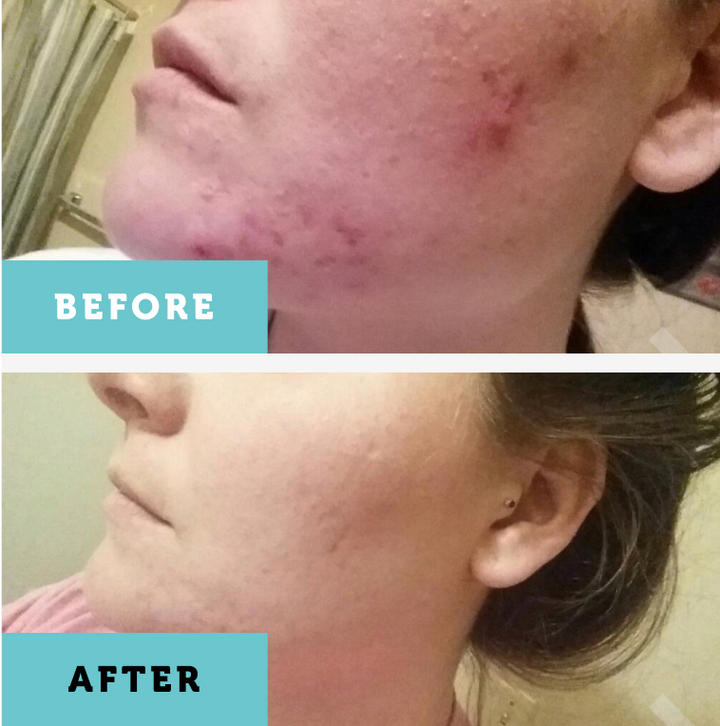 Before and after photo shared by a customer